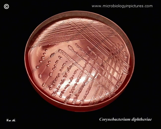 Corynebacterium diphtheriae on sheep blood agar plate (BAP). Appearance of C.diphtheriae growing